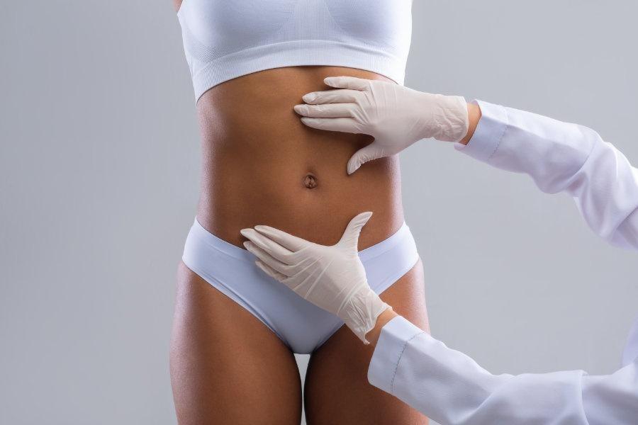 Fettabsaugen fettabsaugung - fett absaugung - liposuktion