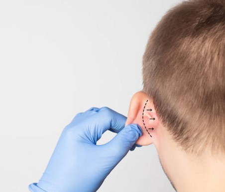 ear2